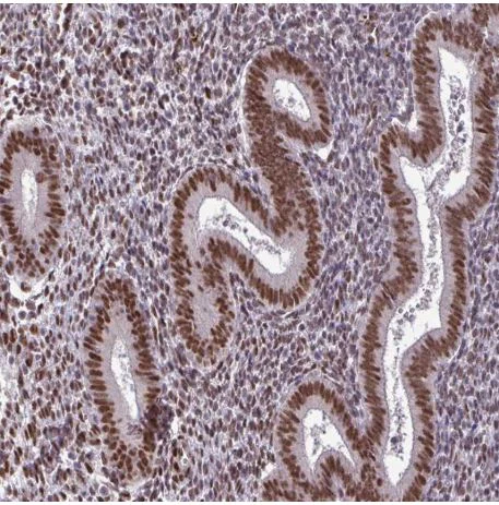 Immunohistochemistry (Formalin/PFA-fixed paraffin-embedded sections) - Anti-TTF1/Transcription termination factor 1 antibody (AB204411)