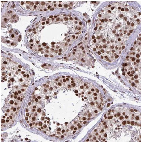 Immunohistochemistry (Formalin/PFA-fixed paraffin-embedded sections) - Anti-TTF1/Transcription termination factor 1 antibody (AB204411)