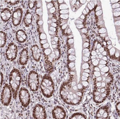 Immunohistochemistry (Formalin/PFA-fixed paraffin-embedded sections) - Anti-TTF1/Transcription termination factor 1 antibody (AB204411)