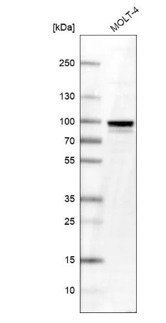 Western blot - Anti-TTF1/Transcription termination factor 1 antibody (AB204411)