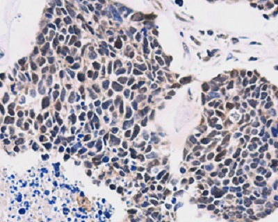 Immunohistochemistry (Formalin/PFA-fixed paraffin-embedded sections) - Anti-TTF1/Transcription termination factor 1 antibody (AB229564)
