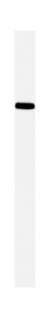 Western blot - Anti-TTF2 antibody (AB28030), expandable thumbnail
