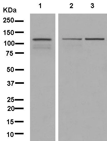 Western blot - Anti-TTF2 antibody [EPR12756] (AB181116)