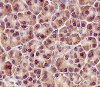 Immunohistochemistry (Formalin/PFA-fixed paraffin-embedded sections) - Anti-TTF2 antibody [EPR12756] - BSA and Azide free (AB240241)