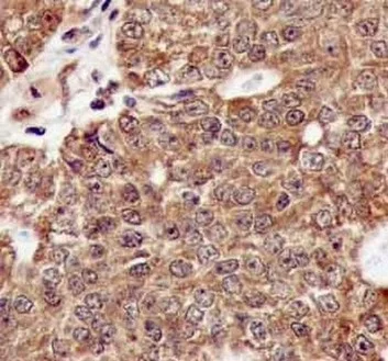 Immunohistochemistry (Formalin/PFA-fixed paraffin-embedded sections) - Anti-TTF2 antibody [EPR12756] - BSA and Azide free (AB240241)
