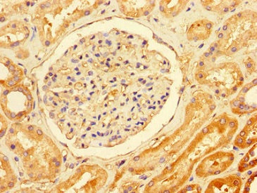 Immunohistochemistry (Formalin/PFA-fixed paraffin-embedded sections) - Anti-TTI1 antibody (AB234871)