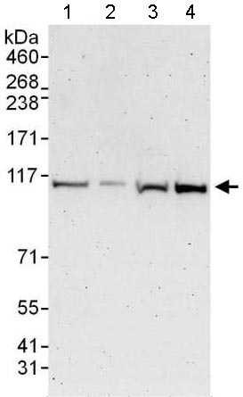 Western blot - Anti-TTI1 antibody - N-terminal (AB176696)