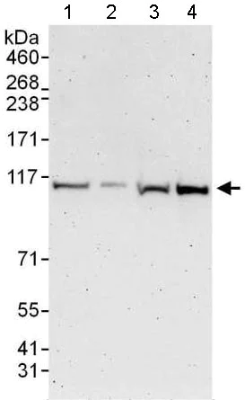 Western blot - Anti-TTI1 antibody - N-terminal (AB176696)