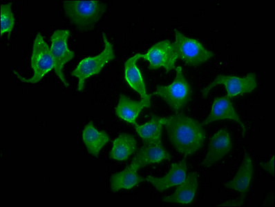 Immunocytochemistry/ Immunofluorescence - Anti-TTI2 antibody (AB237048)