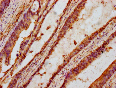 Immunohistochemistry (Formalin/PFA-fixed paraffin-embedded sections) - Anti-TTI2 antibody (AB237048)