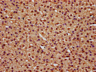 Immunohistochemistry (Formalin/PFA-fixed paraffin-embedded sections) - Anti-TTI2 antibody (AB237048)