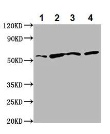 Western blot - Anti-TTI2 antibody (AB237048)