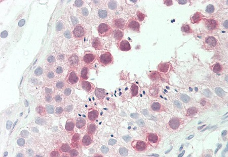 Immunohistochemistry (Formalin/PFA-fixed paraffin-embedded sections) - Anti-TTK/Mps1 antibody [3G7] (AB219068)