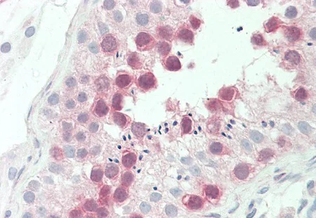 Immunohistochemistry (Formalin/PFA-fixed paraffin-embedded sections) - Anti-TTK/Mps1 antibody [3G7] (AB219068)