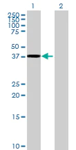 Western blot - Anti-TTLL1 antibody (AB68611)
