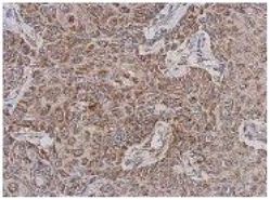 Immunohistochemistry (Formalin/PFA-fixed paraffin-embedded sections) - Anti-TTLL12 antibody (AB154086)