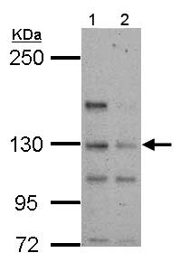 Western blot - Anti-TTLL4 antibody (AB155801), expandable thumbnail