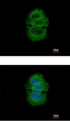 Immunocytochemistry/ Immunofluorescence - Anti-TTPA/TPP1 antibody (AB155323)