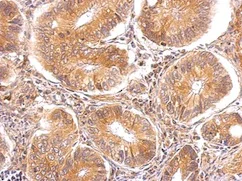 Immunohistochemistry (Formalin/PFA-fixed paraffin-embedded sections) - Anti-TTPA/TPP1 antibody (AB155323)