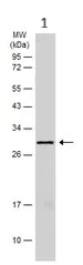 Western blot - Anti-TTPA/TPP1 antibody (AB155323)
