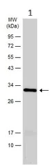 Western blot - Anti-TTPA/TPP1 antibody (AB155323)