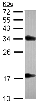 Western blot - Anti-TTPA/TPP1 antibody (AB155323)