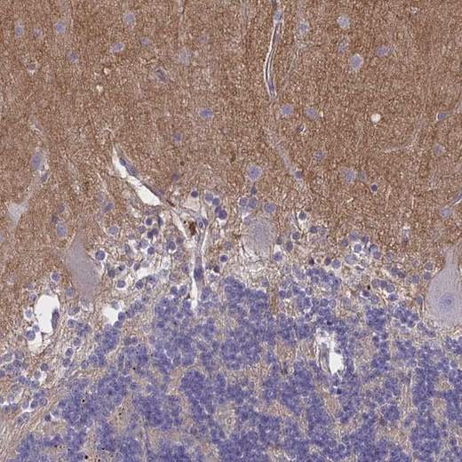 Immunohistochemistry (Formalin/PFA-fixed paraffin-embedded sections) - Anti-TTYH1 antibody (AB204046), expandable thumbnail