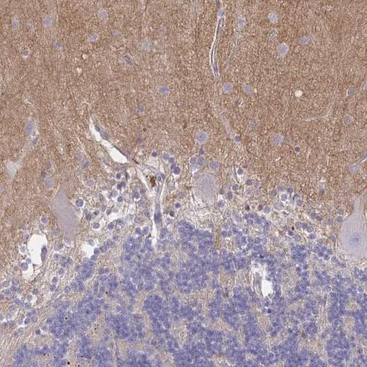 Immunohistochemistry (Formalin/PFA-fixed paraffin-embedded sections) - Anti-TTYH1 antibody (AB204046)
