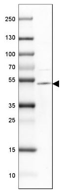 Western blot - Anti-TTYH1 antibody (AB204046), expandable thumbnail