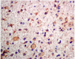 Immunohistochemistry (Formalin/PFA-fixed paraffin-embedded sections) - Anti-TUB 1 antibody [EPR8241] (AB131034)