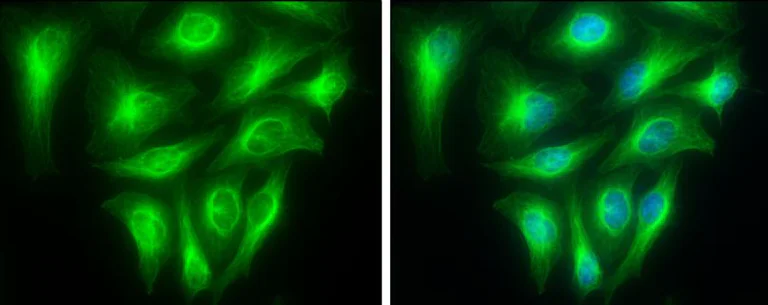 Immunocytochemistry/ Immunofluorescence - Anti-TUBA1A antibody - Loading Control (AB95966)