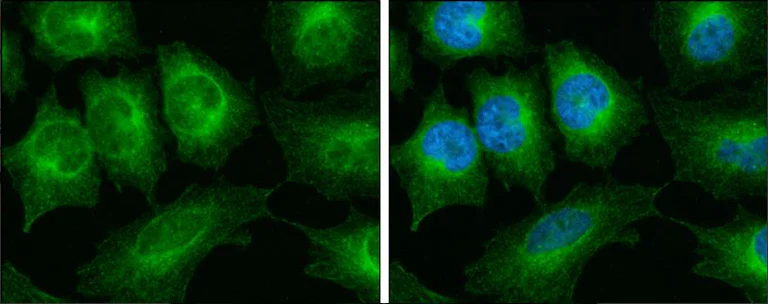 Immunocytochemistry/ Immunofluorescence - Anti-TUBA1A antibody - Loading Control (AB95966)