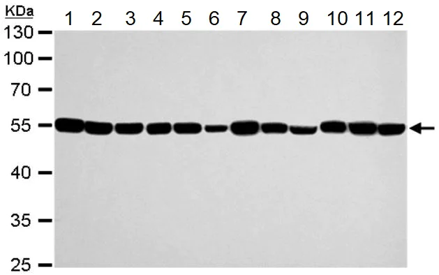 Western blot - Anti-TUBA1A antibody - Loading Control (AB95966)