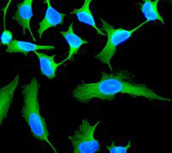 Immunocytochemistry/ Immunofluorescence - Anti-TUBA1B antibody [EPR1333] - Loading Control (ab108629), expandable thumbnail