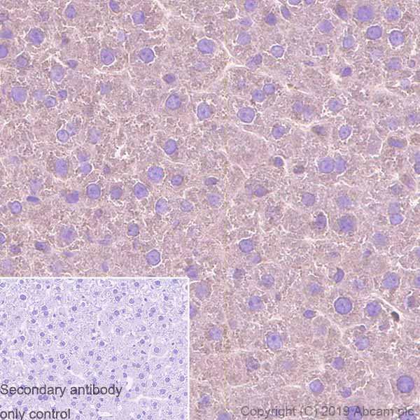 Immunohistochemistry (Formalin/PFA-fixed paraffin-embedded sections) - Anti-TUBA1B antibody [EPR1333] (AB108629), expandable thumbnail