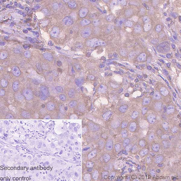Immunohistochemistry (Formalin/PFA-fixed paraffin-embedded sections) - Anti-TUBA1B antibody [EPR1333] (ab108629), expandable thumbnail