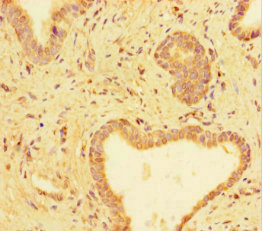 Immunohistochemistry (Formalin/PFA-fixed paraffin-embedded sections) - Anti-TUBA1C antibody (AB222849), expandable thumbnail
