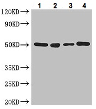 Western blot - Anti-TUBA1C antibody (AB222849), expandable thumbnail