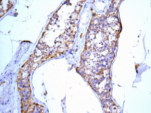 Immunohistochemistry (Formalin/PFA-fixed paraffin-embedded sections) - Anti-TUBA4A antibody [EPR13477(B)] (AB177479), expandable thumbnail