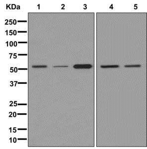 Western blot - Anti-TUBA4A antibody [EPR13477(B)] (AB177479), expandable thumbnail