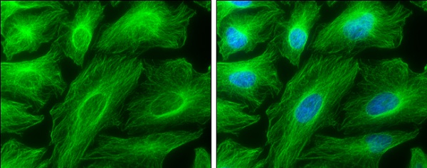 Immunocytochemistry/ Immunofluorescence - Anti-TUBA4A antibody (AB228701), expandable thumbnail
