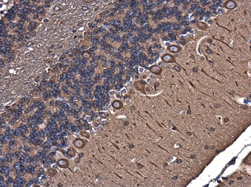 Immunohistochemistry (Formalin/PFA-fixed paraffin-embedded sections) - Anti-TUBA4A antibody (ab228701), expandable thumbnail
