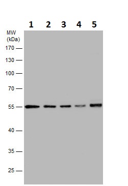 Western blot - Anti-TUBA4A antibody - Loading Control (ab228701), expandable thumbnail