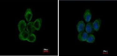Immunocytochemistry/ Immunofluorescence - Anti-TUBA8 antibody (AB154612), expandable thumbnail