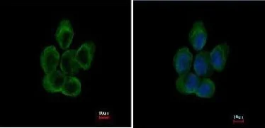 Immunocytochemistry/ Immunofluorescence - Anti-TUBA8 antibody (AB154612)