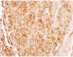 Immunohistochemistry (Formalin/PFA-fixed paraffin-embedded sections) - Anti-TUBA8 antibody (AB154612), expandable thumbnail