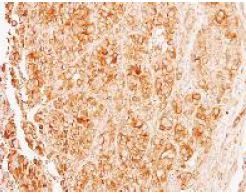 Immunohistochemistry (Formalin/PFA-fixed paraffin-embedded sections) - Anti-TUBA8 antibody (AB154612)