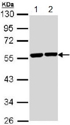 Western blot - Anti-TUBA8 antibody (AB154612), expandable thumbnail