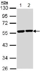 Western blot - Anti-TUBA8 antibody (AB154612)