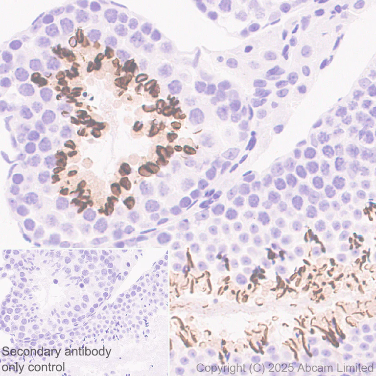 Immunohistochemistry (Formalin/PFA-fixed paraffin-embedded sections) - Anti-TUBA8 antibody [EPR30576-548] (AB325930)